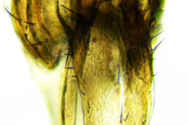 Male, cercus dorsal