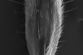 Male, cercus dorsal (Scanning)