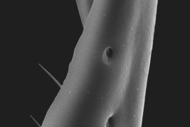 Male, surstylus distal tip (Scanning)