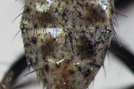 Female, abdomen