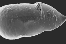 Female, spermatheca (Scanning)