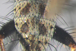 Male, abdomen