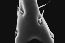 Male, cercus distal tip (Scanning)