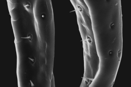 Male, surstylus distal tip (Scanning)