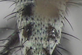 Male, abdomen