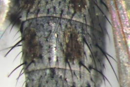 Male, abdomen