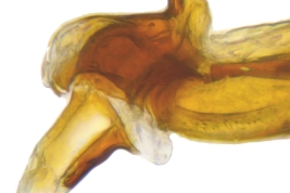 Male, distiphallus