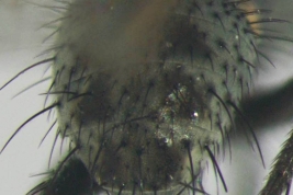 Male, abdomen